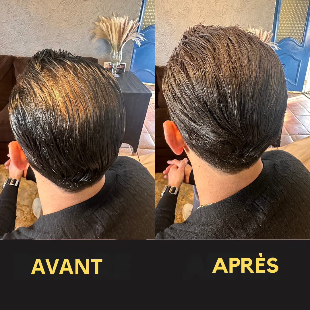 Solution Capillaire - Dermacap