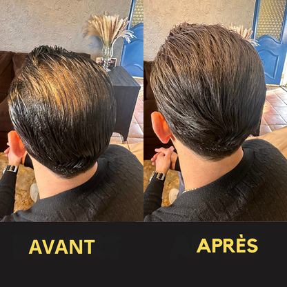 Solution Capillaire - Dermacap