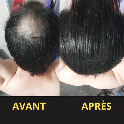 Solution Capillaire - Dermacap