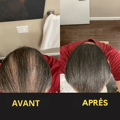 Solution Capillaire - Dermacap