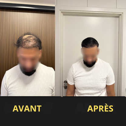 Solution Capillaire - Dermacap