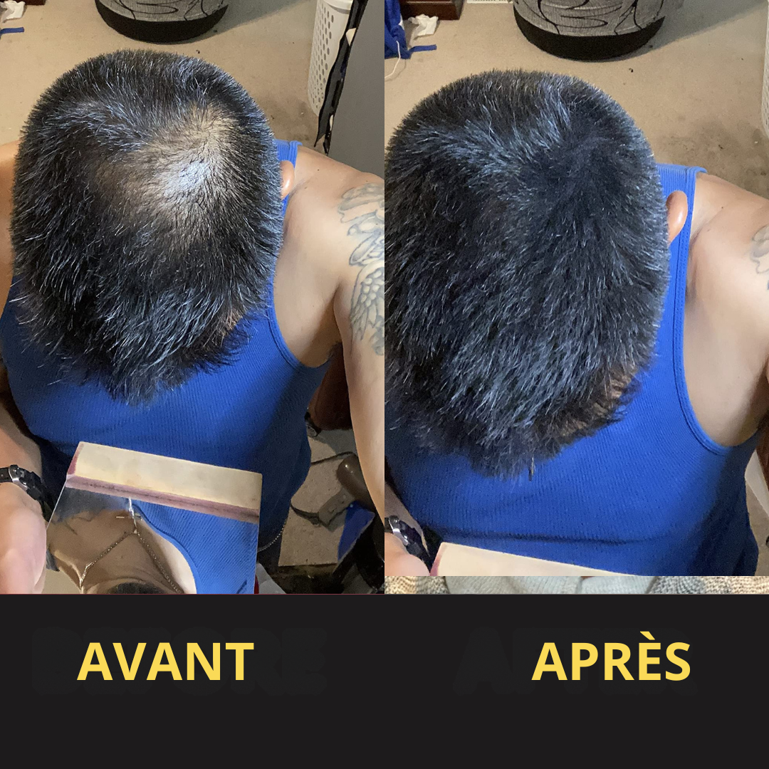 Solution Capillaire - Dermacap