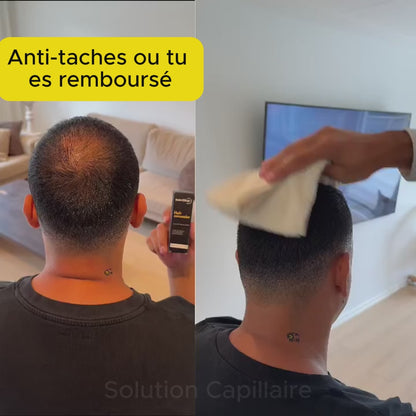 Solution Capillaire - Dermacap