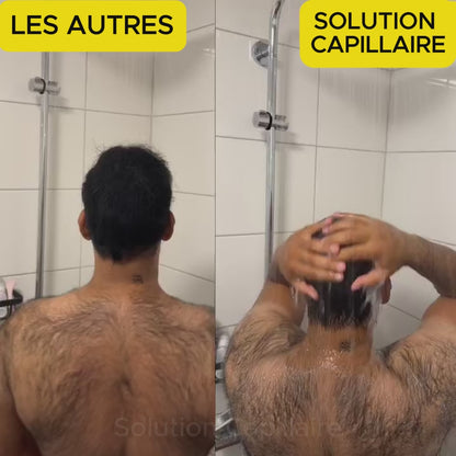 Solution Capillaire - Dermacap